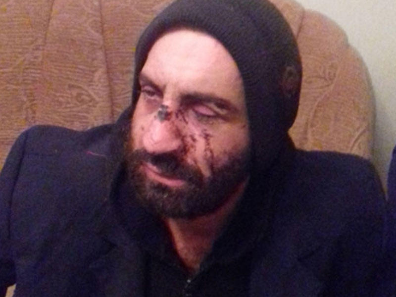 Quba sakinini meşədə vəhşicəsinə döydülər