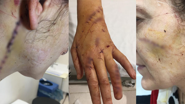 Sevgilisi tərəfindən bıçaqlanan qadın qorxunc hala düşdü - Dəhşətli FOTOLAR