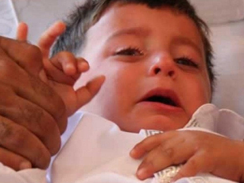 Evdə sünnət faciəylə bitdi - FOTO