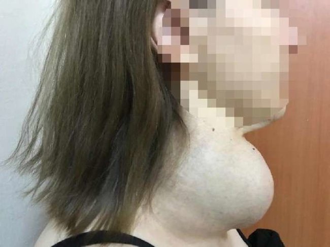 30 il əməliyyat olunmaqdan qorxan qadın bu hala gəldi - FOTO