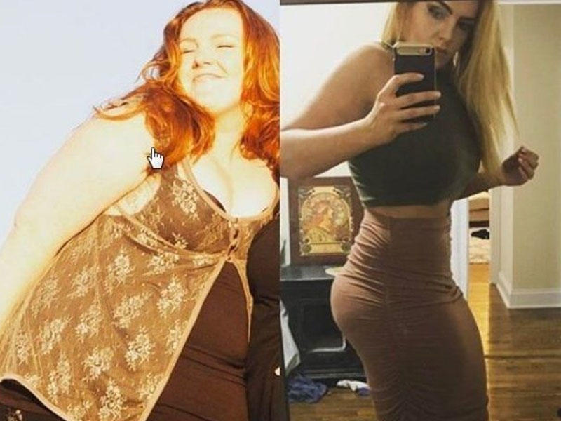 Yerindən güclə tərpənirdi, indi arıqlamaq istəyənlər onu izləyir - Dəyişikliyi ilə heyran qoyan qızın FOTOLARI