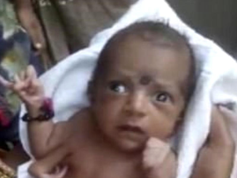 Hindistanda 3 qollu uşağı Allah bilib, ibadət etdilər - VİDEO - FOTO