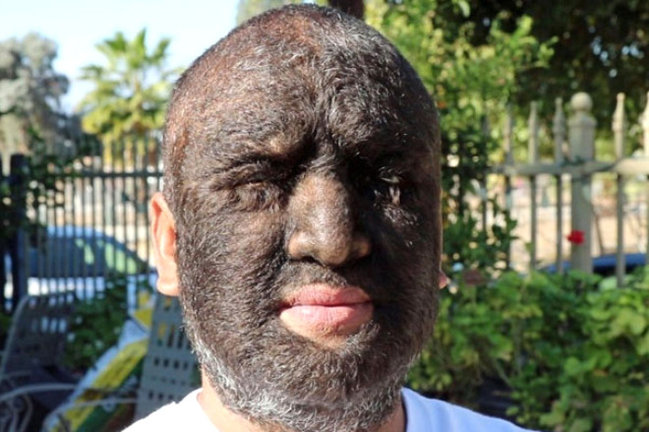 Dünyanın ən tüklü insanı - Hamı ondan danışır - FOTOLAR