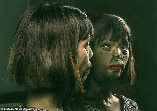 Qız doğulduğuna görə atası tərəfindən işgəncəyə məruz qaldı: Kislota ilə... - FOTOLAR