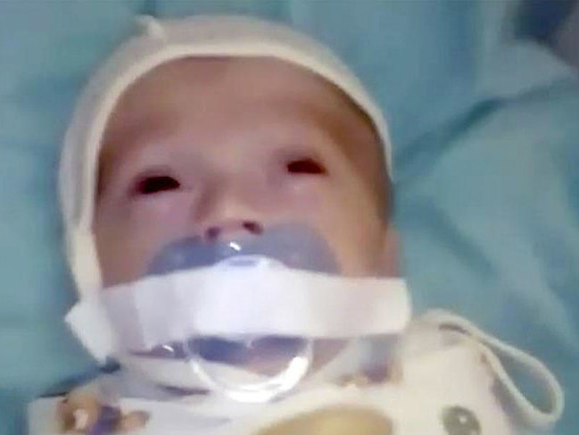 Şok kadrlar: doğum evində körpənin ağzına skotç vurdular - VİDEO - FOTO