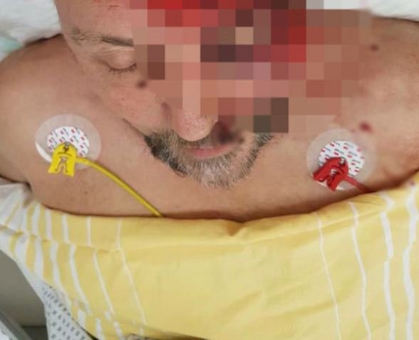 3 kişi birləşərək deputatı vəhşicəsinə döydü ( + 18 FOTO )