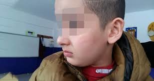 Müəllim ağır xəstəlikdən əziyyət çəkən şagirdi döydü, nazirlik işə qarışdı - VİDEO