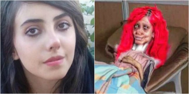 Tanınmaz halda olan qız