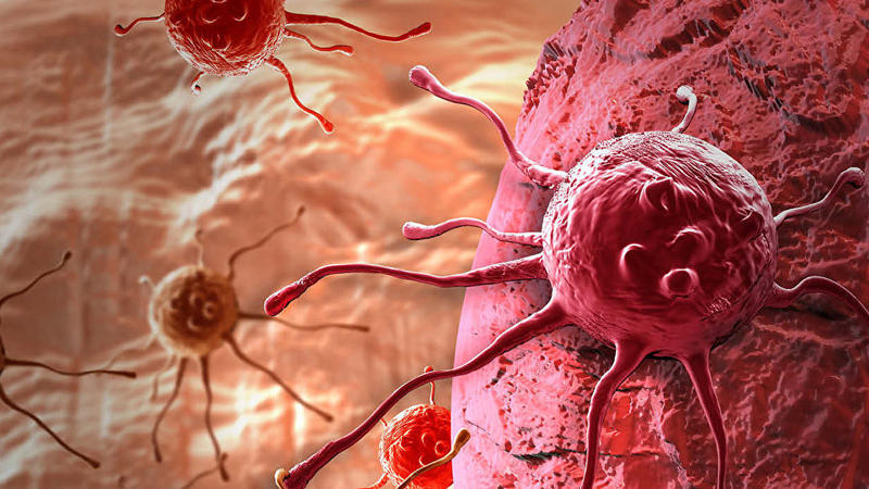 Xərçəngin yeni müalicəsi TAPILDI - Alimlər İNANILMAZI BACARDI