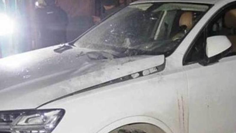 Dəhşətli hadisə: biznesmen GÖZLƏRİNİ İTİRDİ - ANBAAN VİDEO