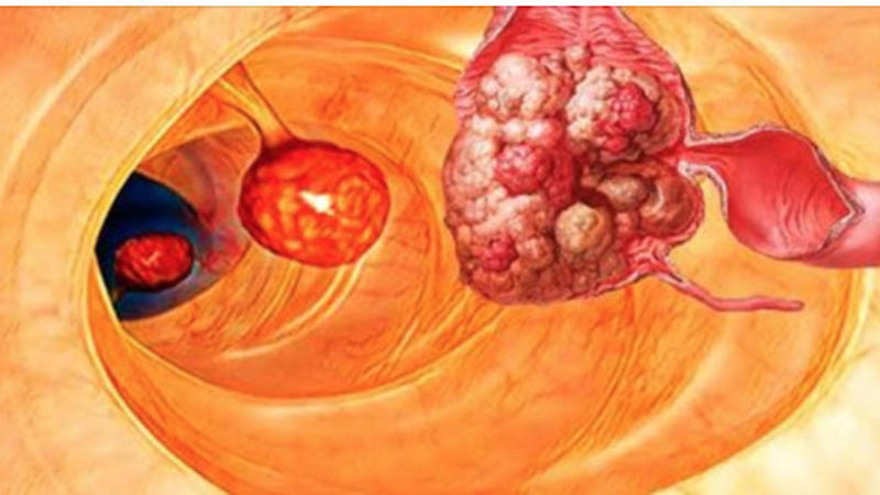 Bütün xəstəliklərin yaranma səbəbi BU İMİŞ - Məşhur cərrahdan İNANILMAZ ARAŞDIRMA