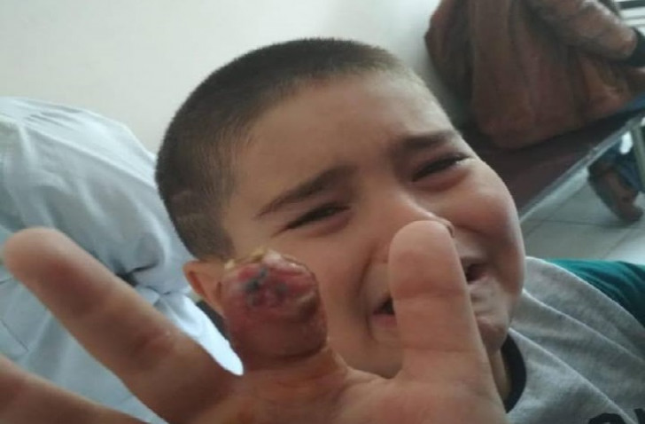 Plastik cərrah Vaqif Qələndərli 8 yaşlı uşağı şikəst edib- iş prokurorluqdadır+FOTOLAR