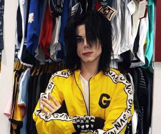 Maykl Ceksona bənzəmək üçün 11 əməliyyat keçirdi - FOTO