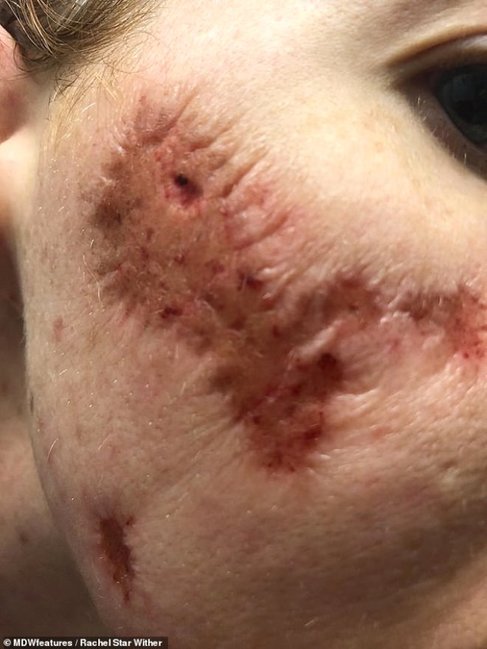 33 yaşlı qadının bədəni çürüməyə başladı, müayinənin nəticəsi şoka saldı - FOTOLAR