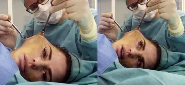 Məşhur aktrisa üzünü dartdırmışdı, bu da son görüntüsü - FOTOLAR