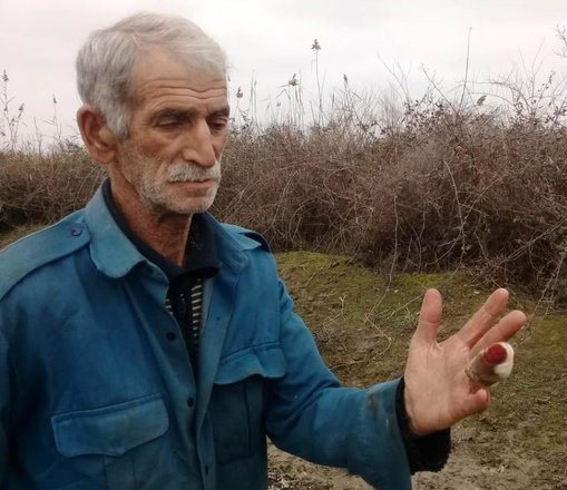 Çaqqal kəndliyə hücum edib barmağını qopardı - Azərbaycanda - FOTOLAR