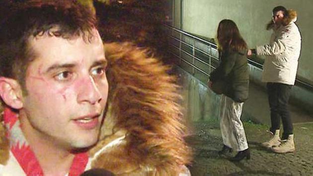 Sevgilisinin üzünü cızması filminin çəkilişini dayandırdı