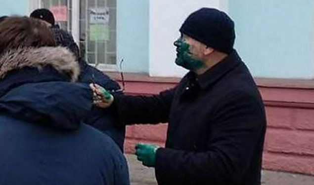 Prezidentliyə namizədin üzünə