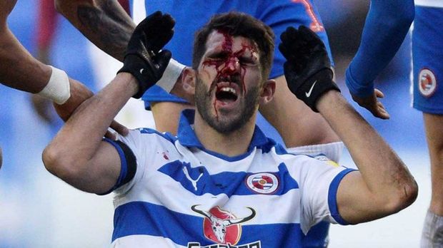 İngiltərədə müdafiəçi hücumçunun üzünü tapdaladı - FOTO/VİDEO