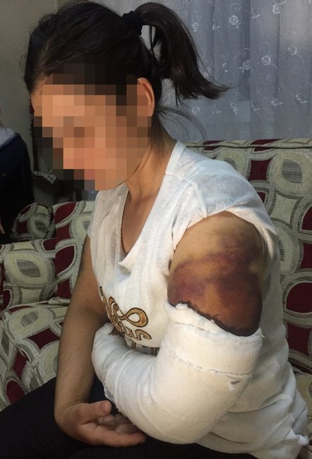 Ailə vəhşəti! 30 dəqiqə həyat yoldaşını inşaat dəmiri ilə... FOTOLAR (18+)