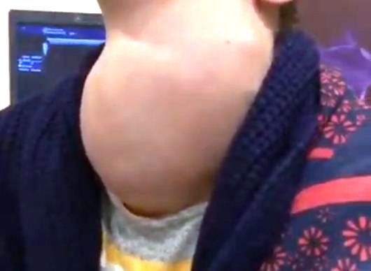 Azərbaycanda xəstənin zobu hər kəsi dəhşətə gətirdi – Video