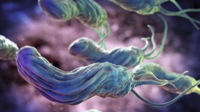 Xərçəngdən də QORXUNC XƏSTƏLİK: 24 saata öldürür - FOTO