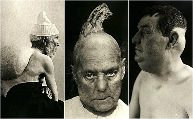 Başındakı buynuzla gəzən qadının fotoları görənləri dəhşətə gətirir