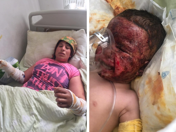 Маленькая Анжела пострадала при пожаре в доме. Надежда на ее спасение есть. Нужна ваша помощь!