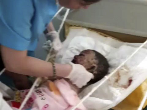 Azərbaycanda dəhşət: atası yanan körpənin müalicəsinə razı deyil? - VİDEO