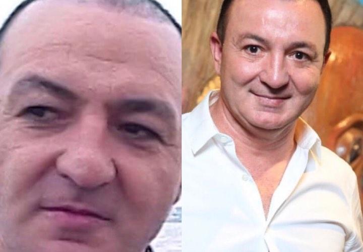 Vasif üzünə botoks etdirib? - Foto
