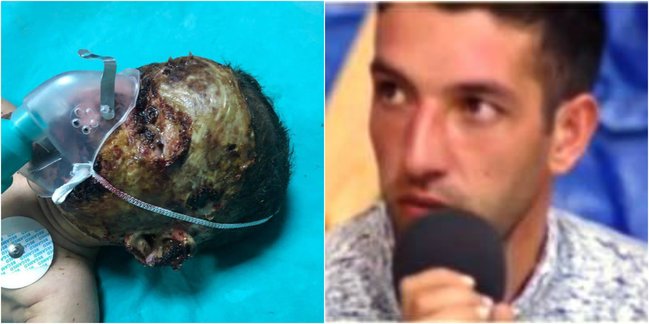 Azərbaycanda 2 yaşlı uşağın üzünə benzin töküb yandırdılar - Atasından ŞOK SÖZLƏR (+18 FOTOLAR)