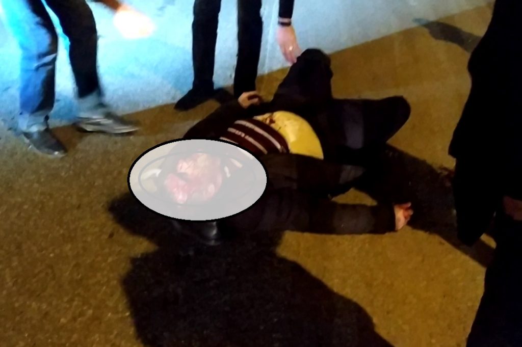 Bakıda BMW Piyadanı Vurub Bu Hala Saldı – Ürəyi Zəif Olanlar Baxmasın – VİDEO