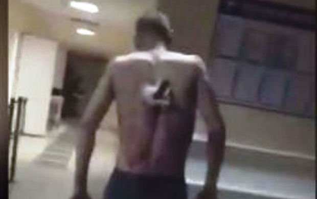 Tatarıstanda yaralı kürəyində bıçaqla siqaret çəkməyə çıxdı - VİDEO