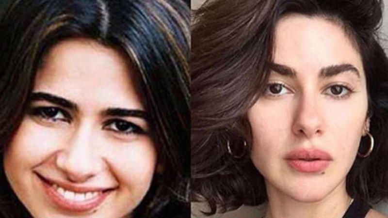 Nəsrindən estetik əməliyyat ittihamlarına iynəli cavab - FOTO