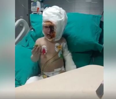Üzünə benzin töküb yandırılan 2 yaşlı uşağın xəstəxanadan SON GÖRÜNTÜSÜ - ÜRƏKPARÇALAYAN VİDEO