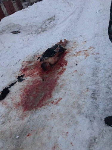 Dəhşətli HADİSƏ: Küçə itləri 25 yaşlı gənci parçalayıb öldürdü - FOTO