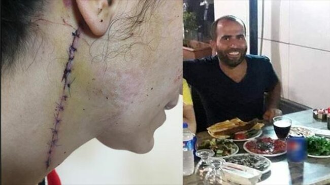 DƏHŞƏT! Yolunu kəsib bu hala saldı/ FOTO