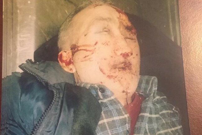 Maşınla vurulub öldürülən piyadanın yaxınları axtarılır - FOTO