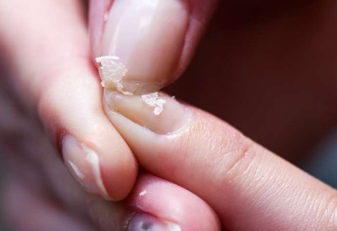 Dırnaqların qırılırsa, bu çatışmır — Nə yeməli?