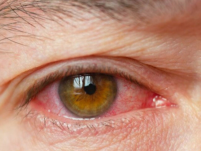 Gözlərimizi kor olmaqdan belə qoruyaq - 8 QIZIL QAYDA