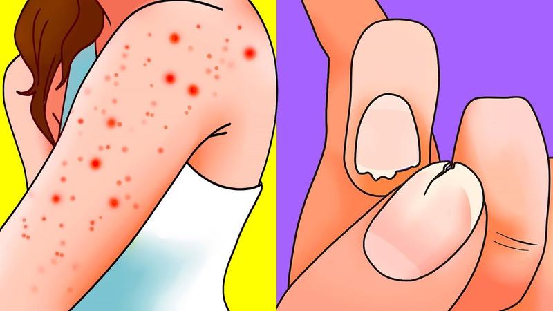 Bədənin sizdən yardım istədiyini göstərən 8 İŞARƏ