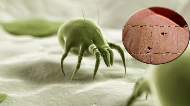 Evinizdəki ÖLÜM TƏHLÜKƏSİ - Onlardan XƏBƏRDARSINIZMI?