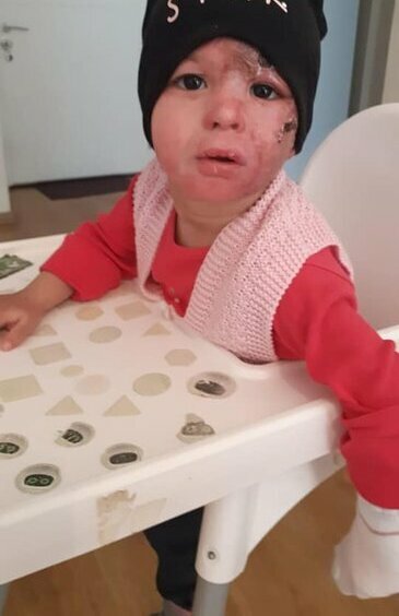 ÜRƏYİ ZƏİF OLANLAR BAXMASIN! Benzin tökülərək yandırılan Anjelanın FOTOLARI