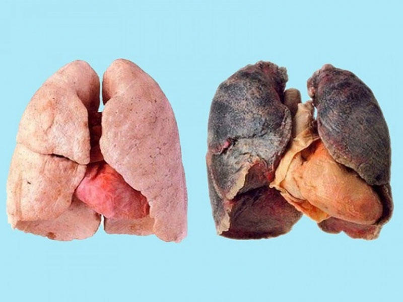 Ağciyərləri nikotindən təmizləmək üçün 9 qayda - Kişilərin diqqətinə