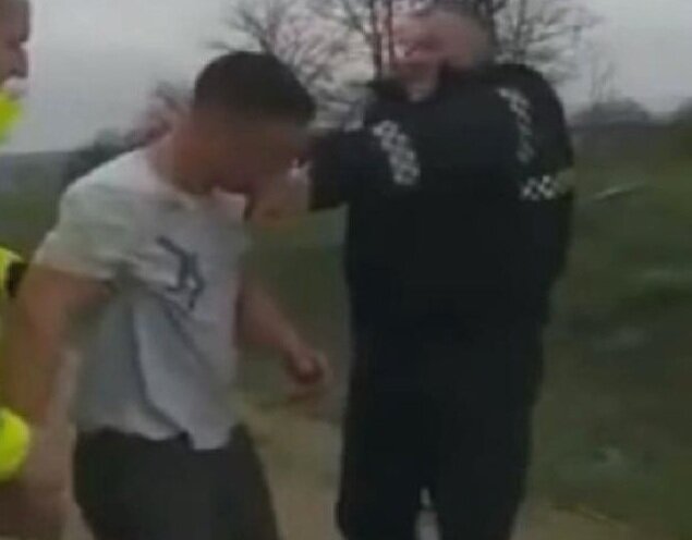 Sərxoş sürücü polisin barmağını 9 dəqiqə dişlədi - FOTOLAR