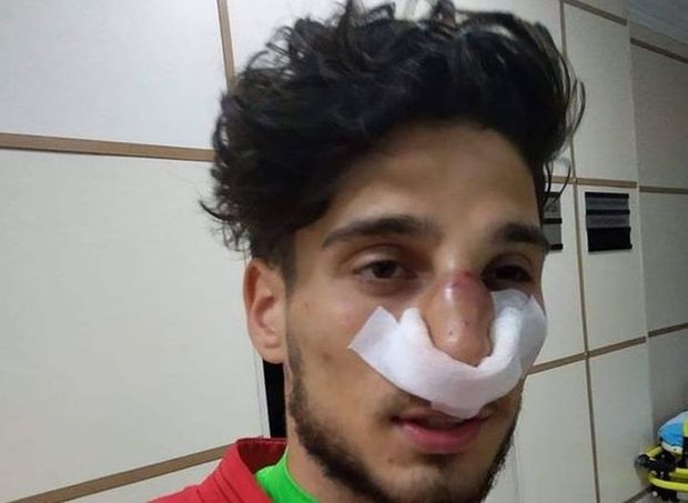 Mahir Mədətov qapıçının burnunu sındırdı - VİDEO