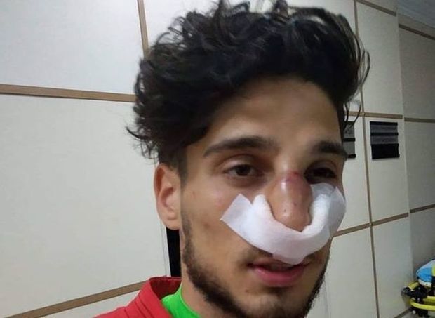 Махир Мадатов сломал нос вратарю «Кешля» - ФОТО/ВИДЕО