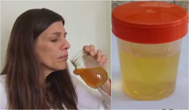 30 gün İDRARINI İÇDİ - Görün, başına nə gəldi / VİDEO