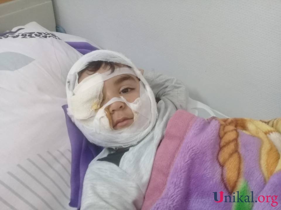 Sulutəpədə it 4 yaşlı uşağın üzünü parçaladı - FOTOLAR