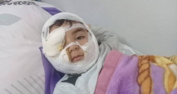 İt dişləyən 4 yaşlı uşaq palataya köçürülüb - Səhiyyə Nazirliyi